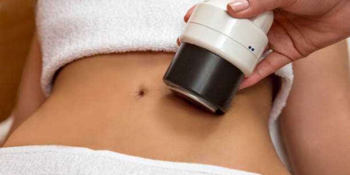 Is coolsculpting an expensive procedure for fat loss?