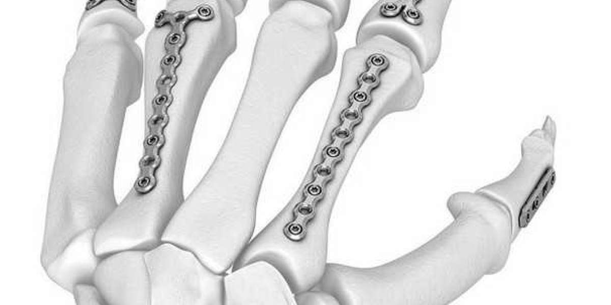 Reliable Orthopedic Manufacturers