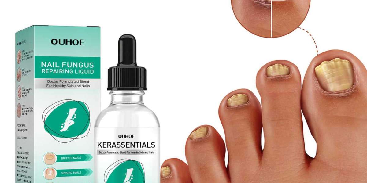 Kerassentials Reviews - Is Truth About The Best Anti-Fungal Formula?