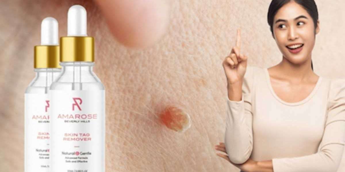 Five Secrets About Amarose Skin Tag Remover That Nobody Will Tell You!