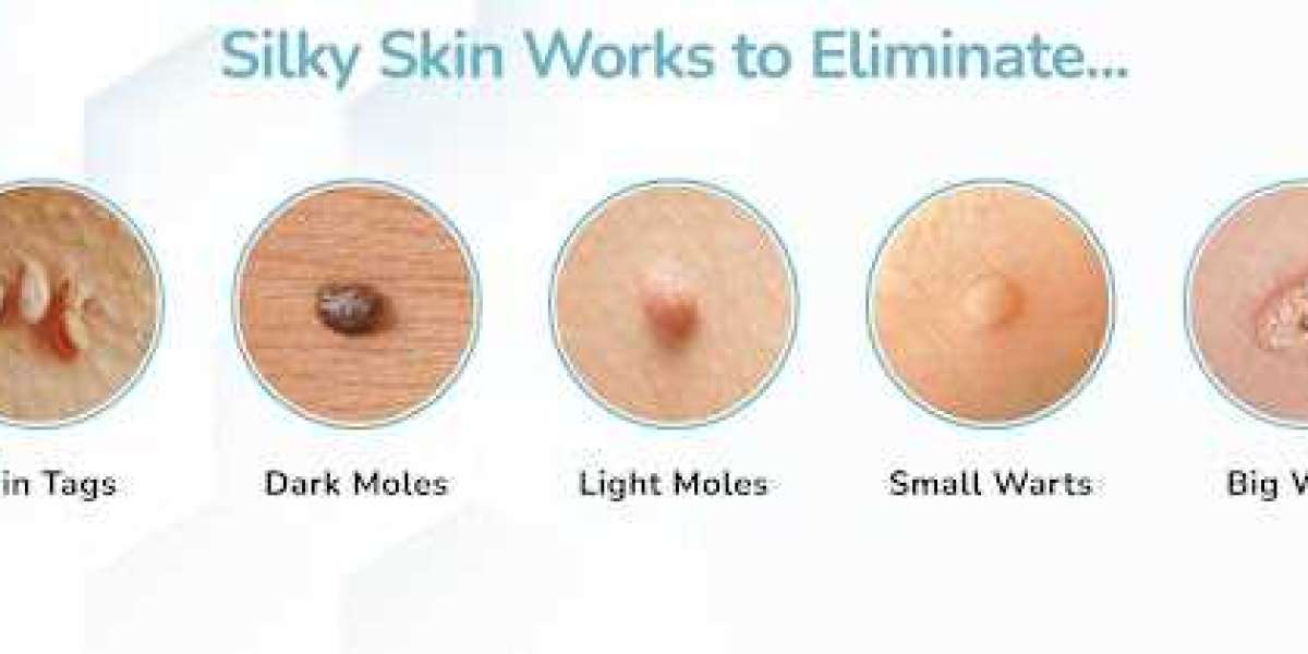 Silky Skin Tag Remover Reviews (Skin Care Serum) SHOCKING Results