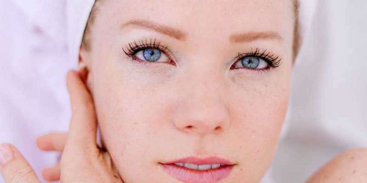 Aesthetically Managing Hyperpigmentation: Treatment Options and Aftercare Tips