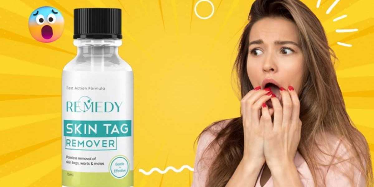 The Latest Remedy Skin Tag Remover Trends: Hip or Hype?