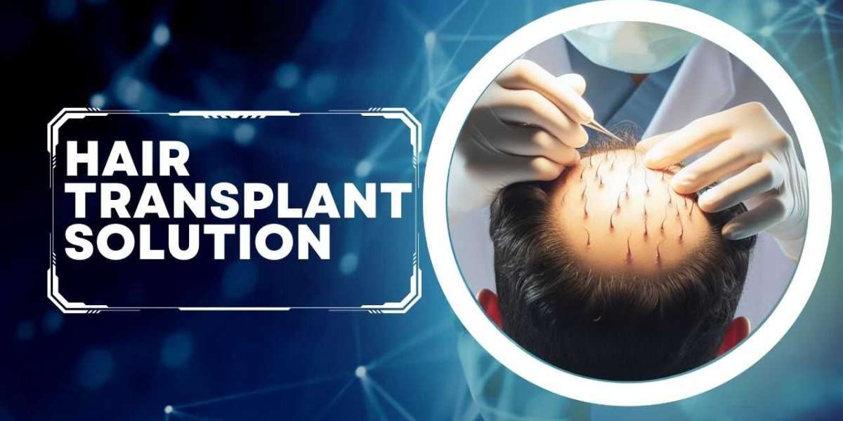 How to Choose the Right Hair Transplant Solutions